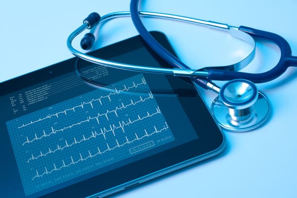 eletrocardiograma digital